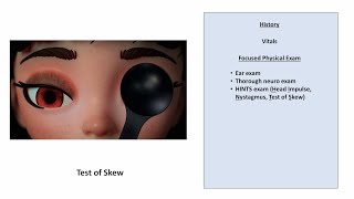 Hyperventilation Test Vestibular Examination [upl. by Notlem450]