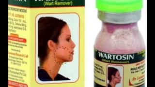 Wartosin Wart Remover [upl. by Notlrac]