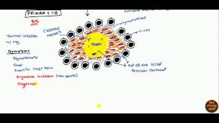 Tuberculosis for USMLE Step 1 and USMLE Step 2 [upl. by Hutton]