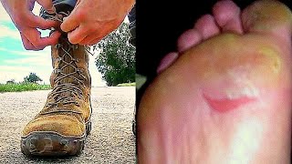 Rucking Foot Care  Blisters amp Pain [upl. by Nallid412]