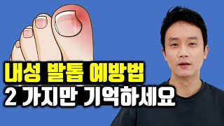 내성 발톱  스스로 예방 amp 치료하는 두 가지 방법 [upl. by Yanarp885]