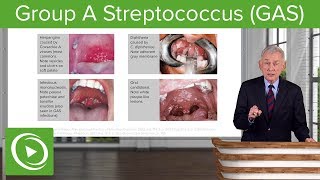 Understanding Streptococcal Diseases [upl. by Ycniuq]