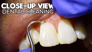 Dental Cleaning  CloseUp View ASMR [upl. by Keel]