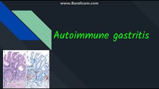 Autoimmune gastritis [upl. by Clemens]