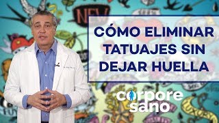 ¿Existe alguna técnica para eliminar tatuajes sin dejar huella [upl. by Otila935]