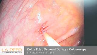 Care Tips for Clove Polyps [upl. by Eiddet]