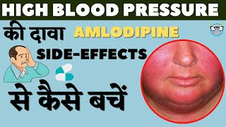 Amlodipine uses side effects and tips to prevent them in hindi  High blood pressure  AmlokindAT [upl. by Animaj933]