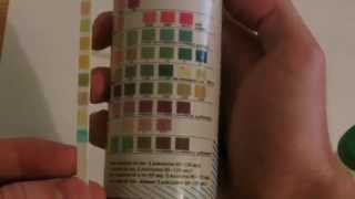 How to perform Urinalysis [upl. by Minier]