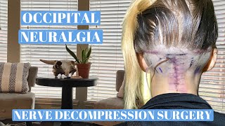 Occipital neuralgia Nerve decompression surgery recovery [upl. by Yecniuq828]