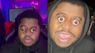 Man Jokingly Rants About Eye Popping Problems [upl. by Evans]