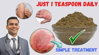 Just 1 Teaspoon Daily To Cure all Your Skin Problems  Eczema  Simple Treatment [upl. by Ecnadnak]