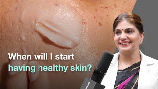 How Long Does It Take to See Healthy Skin  Cureskin [upl. by Ydok]