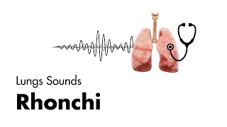 Rhonchi  Lung Sounds  Medzcool [upl. by Lehcem]