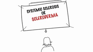 Understanding Systemic Sclerosis [upl. by Amian]