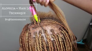 NEW TECHNIQUE ALOPECIA  HAIR LOSS BOX BRAIDS  IRENESBRAIDS [upl. by Ellehctim874]