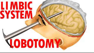 Limbic System Anatomy  Lobotomy And Human Emotions [upl. by Caassi]