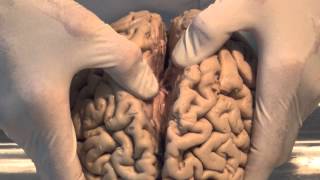 Introduction Neuroanatomy Video Lab  Brain Dissections [upl. by Laing820]