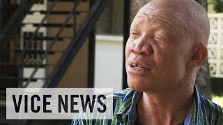 Albino Activism in Tanzania VICE News Meets Josephat Torner [upl. by Gentille239]