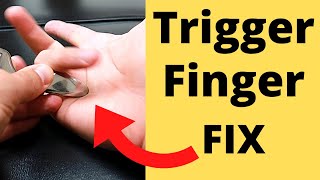 FIX Trigger Finger in 5 Minutes 3 Steps [upl. by Schargel]