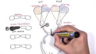 Visual Pathway and Lesions [upl. by Sirapal]