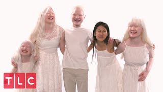 The Grabowskis Unique Adoption Story Part 2  Born With Albinism [upl. by Trinidad]