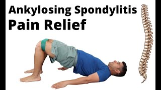 Ankylosing Spondylitis exercises for pain relief [upl. by Indys]