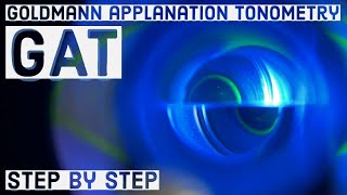 Goldmann applanation Tonometry GAT  basic STEP BY STEP GUIDE [upl. by Kristyn]