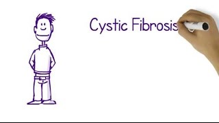 What Is Cystic Fibrosis [upl. by Flagler]