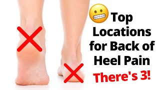 How To Treat Nerve Pain in the Foot Toes amp Legs Causes amp Treatment [upl. by Benton182]