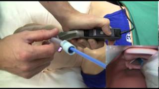 Direct amp Video Laryngoscopy [upl. by Cartwright]