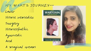 Wartosin review  best wart removal cream  laser surgery Ayurveda homeopathic home remedies [upl. by Leiuqeze409]