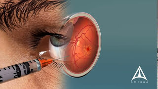 How To Draw Correction For Myopic Eye  Fine Arts Guruji [upl. by Phedra]