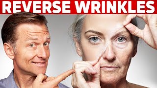 How To Reverse Wrinkles  – DrBerg on Anti Aging Hormones [upl. by Eenram983]