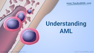 Understanding AML [upl. by Enyleuqcaj]