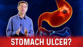 How To Get Rid Of Stomach Ulcer – DrBerg On Peptic Ulcer Treatment [upl. by Duwad527]