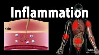 Inflammatory Response Animation [upl. by Timmons]