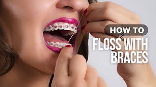 How to Floss with Braces [upl. by Sherourd169]