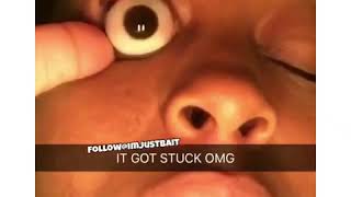 Eye pops out  Popular Insta Videos [upl. by Tratner116]