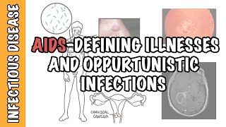 Opportunistic Infections and AIDSdefining illnesses  CD4 cell count malignancy treatment [upl. by Nosidda]