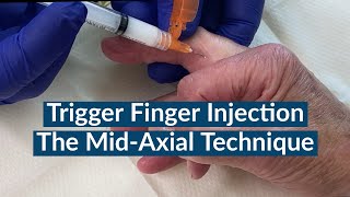 Trigger Finger Injection  The MidAxial Approach [upl. by Ines]