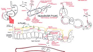 Microbiology  Helicobacter Pylori Ulcer [upl. by Specht]