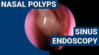 Seaview Science Video Coral Polyps [upl. by Seftton77]