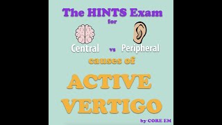 The HINTS Exam [upl. by Iroc]