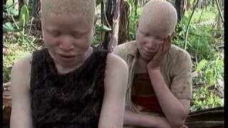 Deadly Hunt Albinos in Tanzania [upl. by Carbrey]