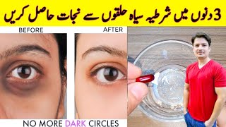 How To Remove Dark Circles Naturally in 3 Days By ijaz Ansari  Dark Circles Homemade Removal Cream [upl. by Thora]